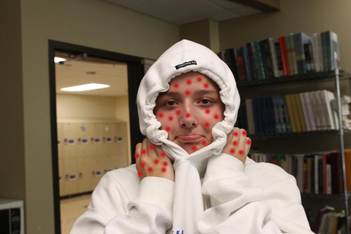 Bekah Thoenen (Senior) posing sadly for a picture of her with monkeypox